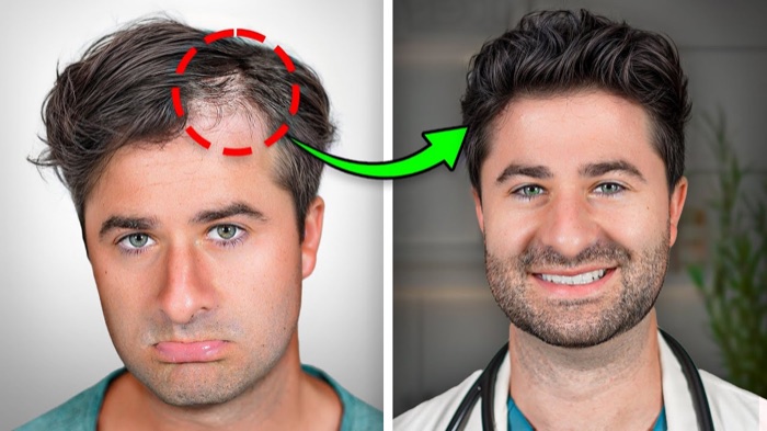 Exemplo de thumbnail Antes e Depois