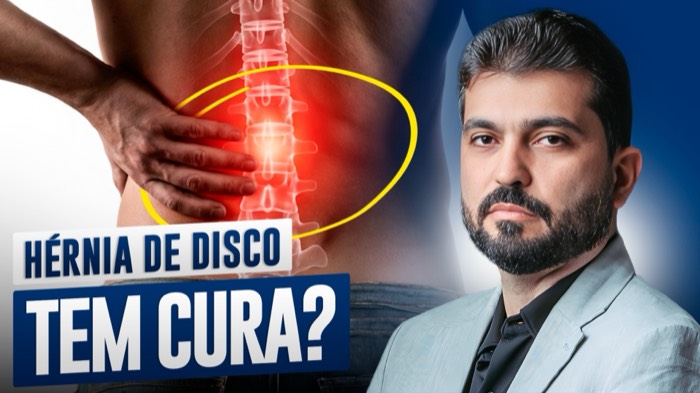 Thumbnail produzida para cliente